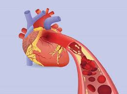 پاورپوینت تغییرات فیزیولوژیک قلب ، عروق و گردش خون در حاملگی