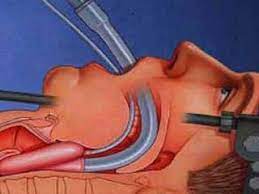 پاورپوینت اداره راه هوایی و لوله گذاری داخل نای